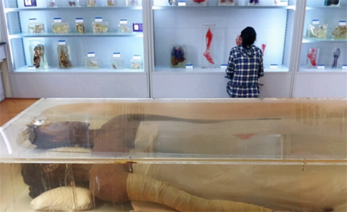 2.3米女巨人为什么去世,2米女巨人去世