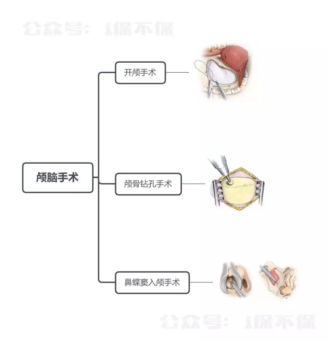 重疾险的六大误区包括,你知道的重疾险