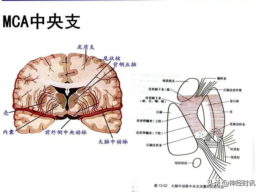 脑动脉解剖学讲解,基底节区脑血管解剖