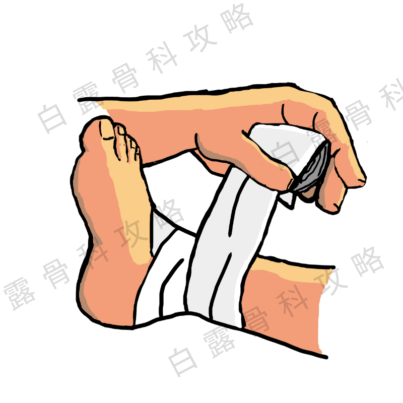 崴脚急诊能处理吗,疫情在家崴脚怎么处理