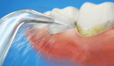 牙科谣言大全,牙科谣言都是真的吗