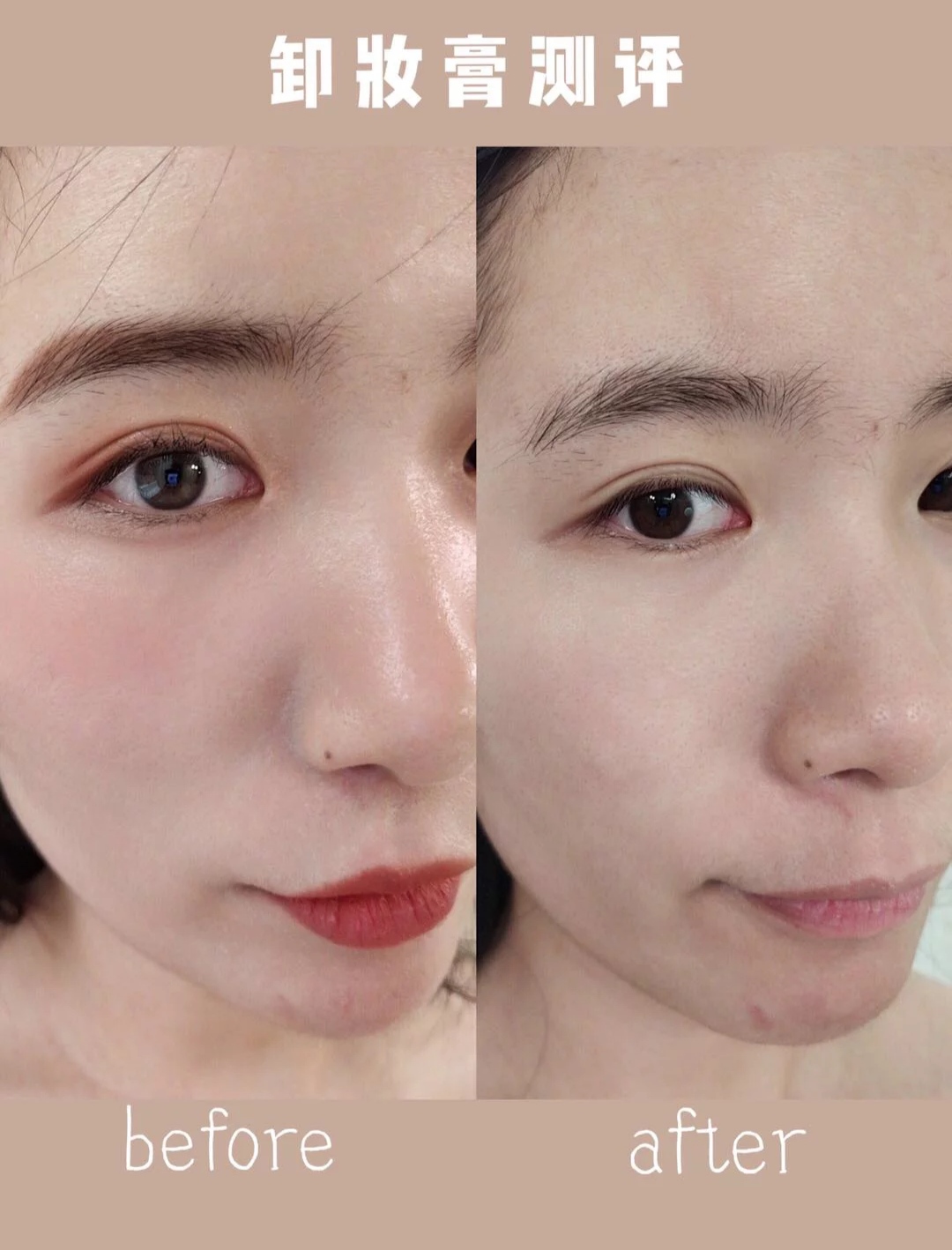 卸妆用什么化妆膏最好最实用,什么卸妆膏闷痘