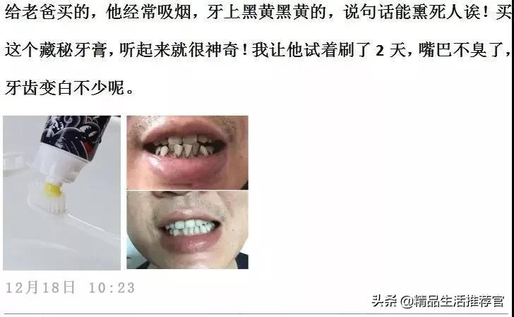 牙黄口臭一招搞定,美白牙齿最有效的方法洗牙