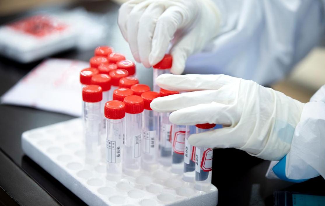 热景生物估值分析,热景生物明日走势分析