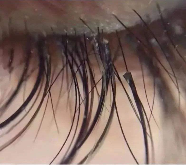 经常种睫毛哪样的好看,经常种睫毛自己的睫毛还会长吗