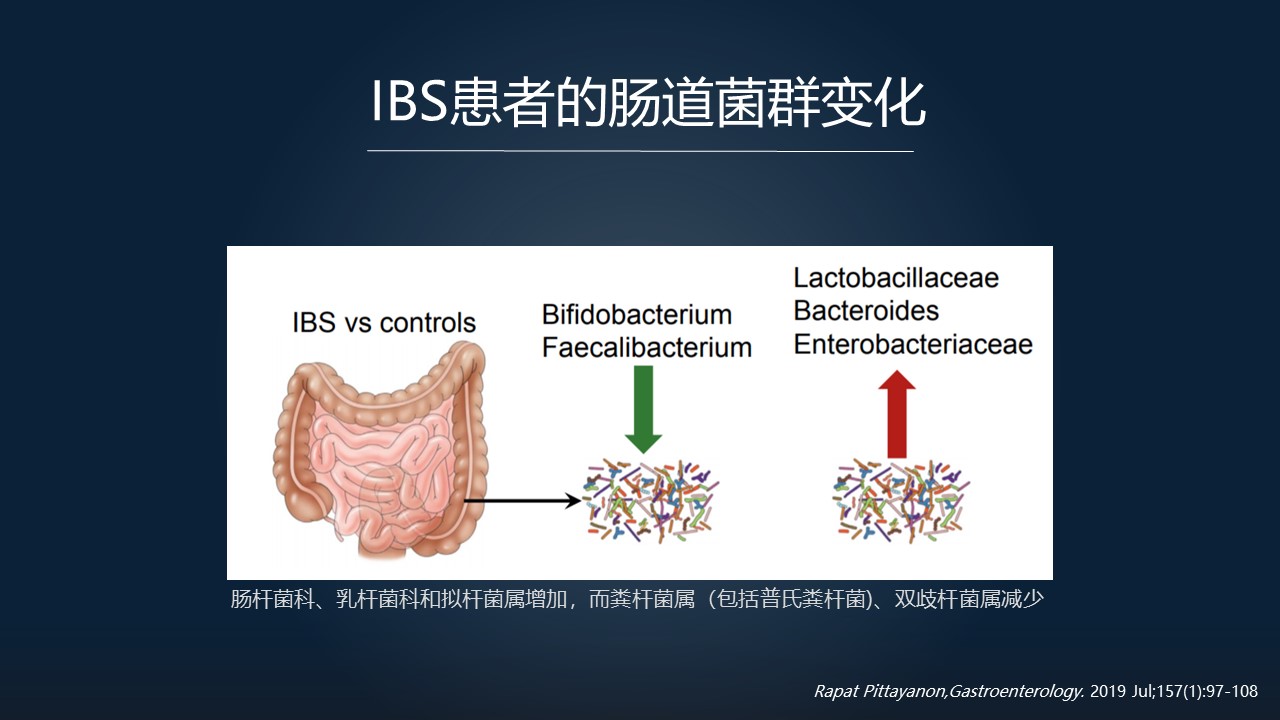 粪菌移植能治疗肠易激综合征吗,肠易激综合征能粪菌移植治疗吗