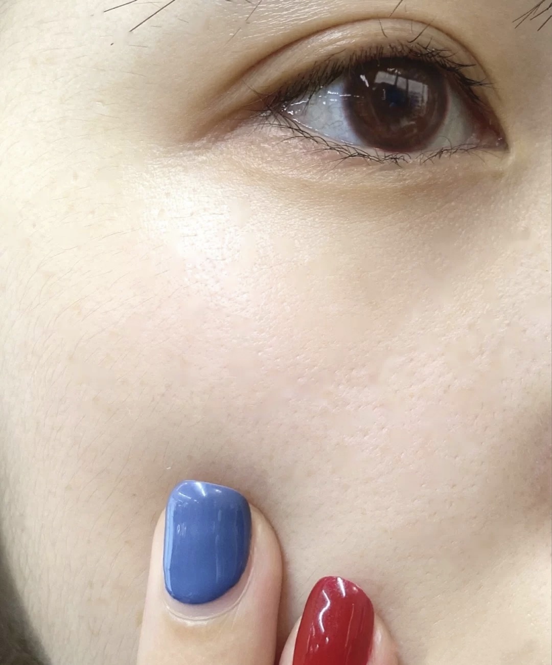 油皮毛孔大泛红怎么改善,干皮毛孔粗大怎么改善小妙招