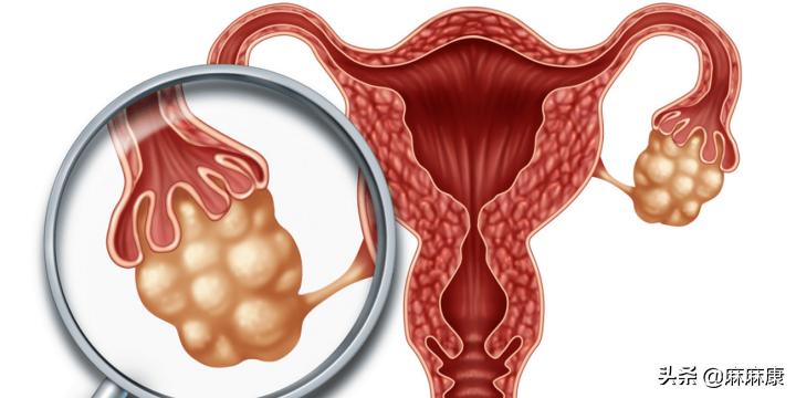 感染了hpv还能补维生素d吗,感染了hpv能理疗好吗