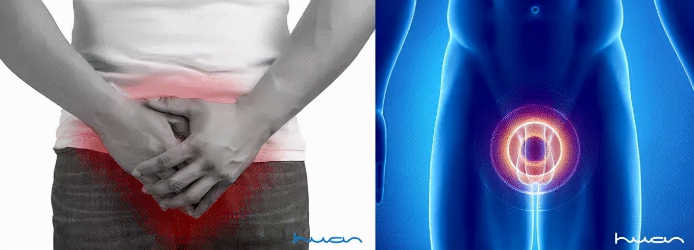 大叔发明了一个镂空车座，堪称骑行时降低屁股疼痛的神器