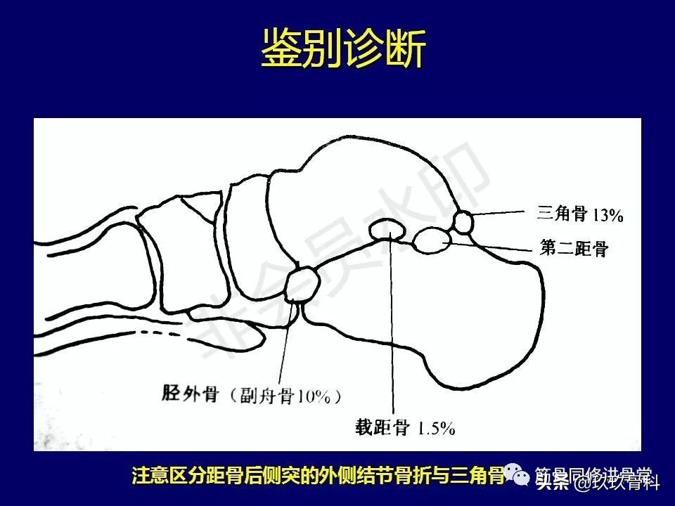 距骨骨折后遗症,距骨骨折怎么办