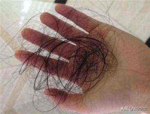 产妇产后出汗多原因及措施,产后掉头发怎么办快速解决