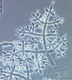 木霉如何防治,木霉菌防治什么病害