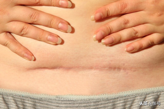 剖腹产10年子宫瘢痕已修复,子宫疤痕只有2mm可以顺产吗