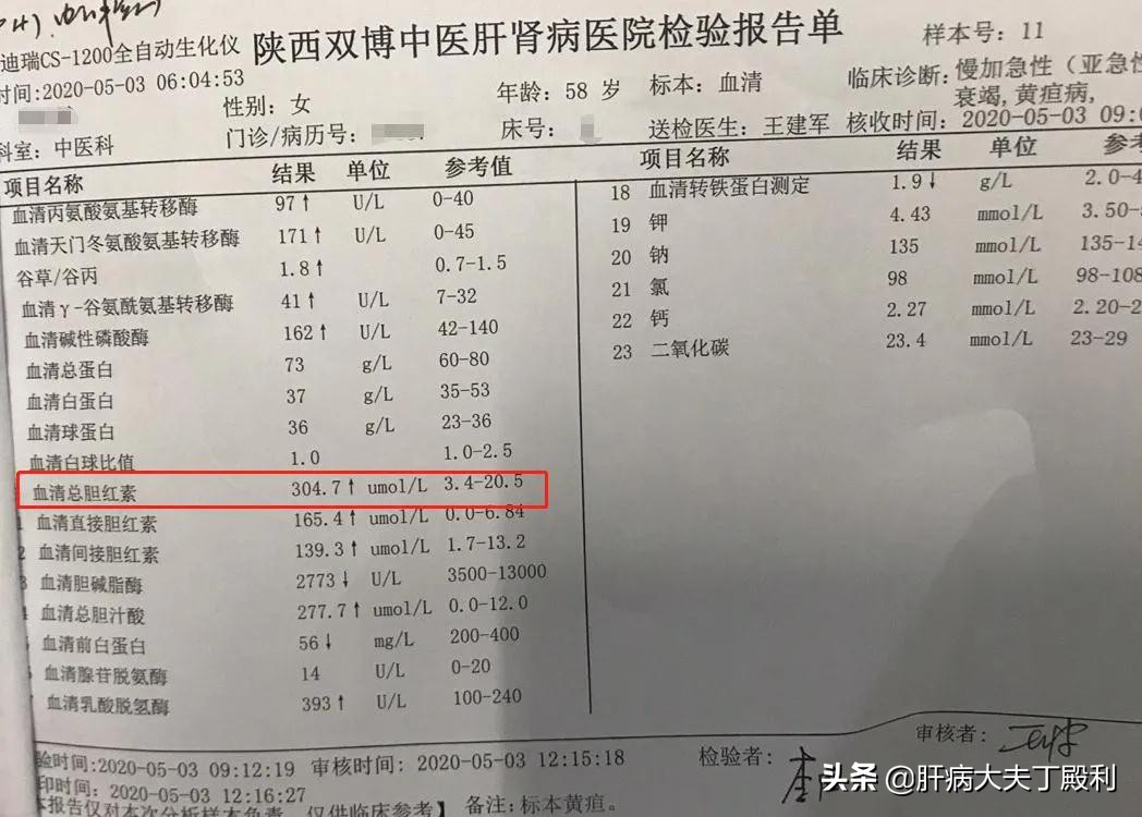 肝移植是治疗肝衰竭最好的手段,肝衰竭放弃肝移植