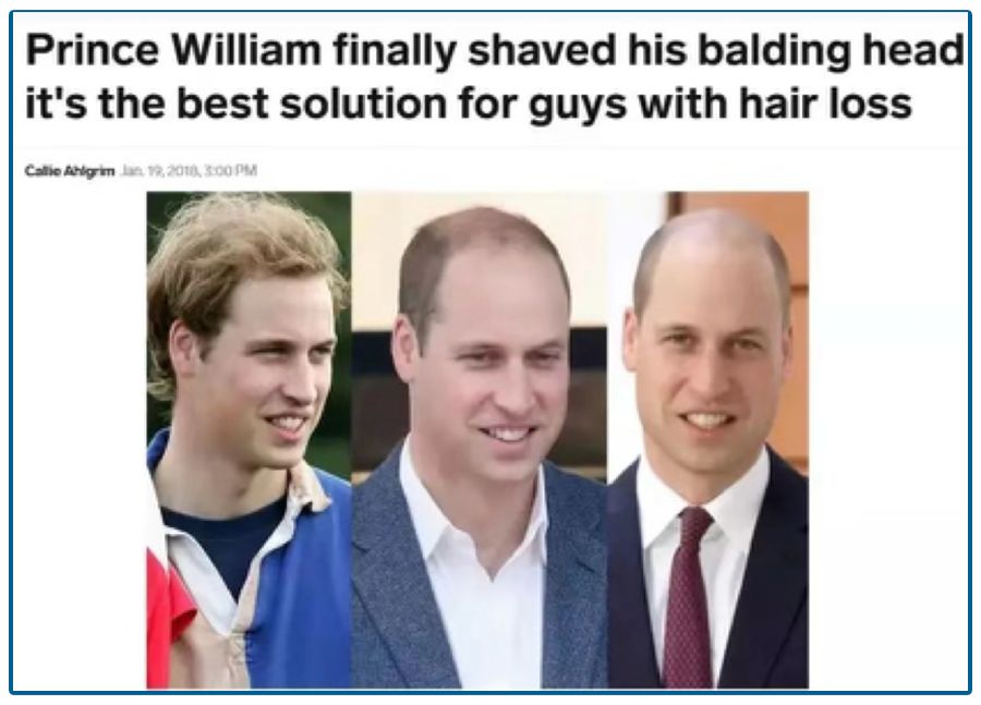 2.5亿人的烦恼，男神女神大佬都躲不过，却引爆了千亿市场