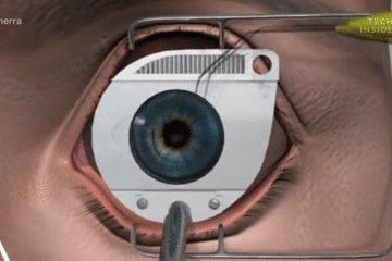 医生手术后最想做什么,医生做完手术以后会怎样