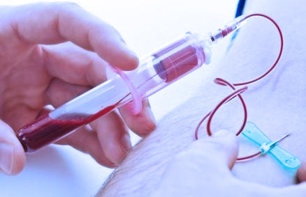 口腔反复溃疡出血,口腔出血警惕四种病