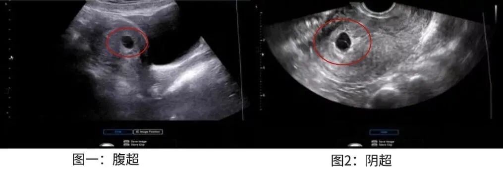 为什么去医院医生问有没有结婚,为什么检查会问有没有男朋友