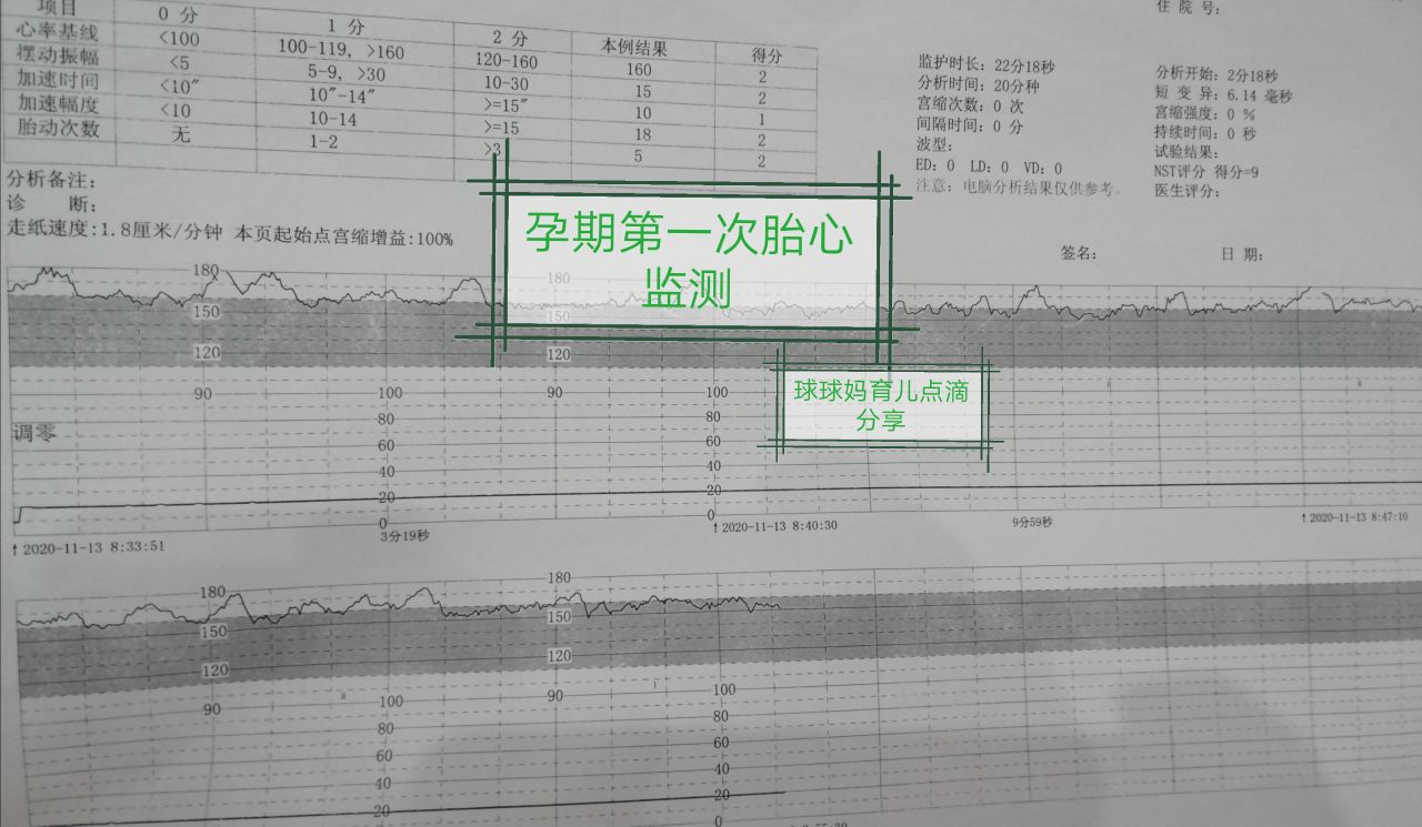 宝宝b超显示小了5天,宝宝b超偏小3周预产期会推后吗