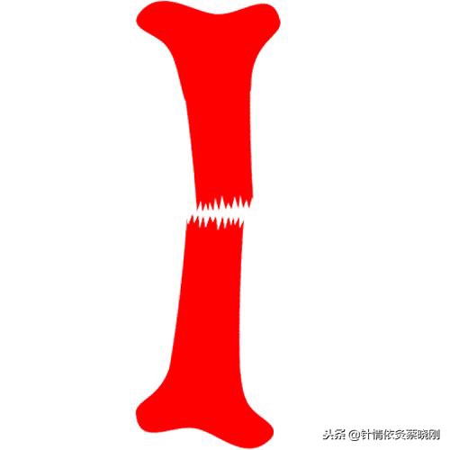 中医针灸对骨折的治疗,中医针灸治疗骨折不愈合是啥原理