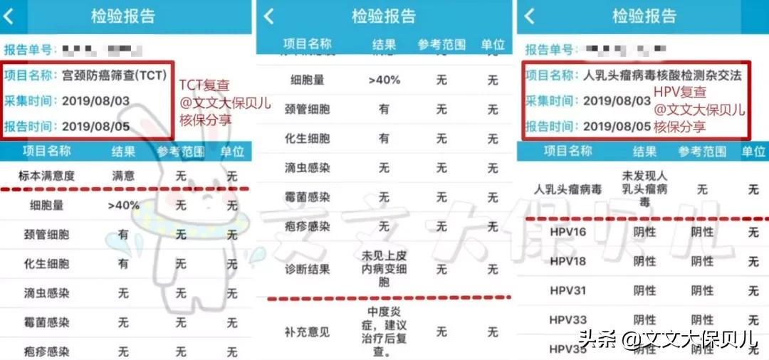 宫颈癌前病变cin3保险理赔吗,上皮内瘤变重疾险赔付吗