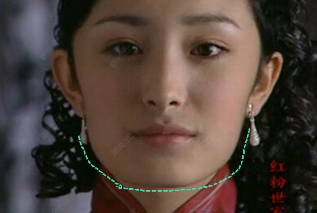 那些一刀切削骨的明星还好吗？后遗症一大堆，小方脸成最大赢家