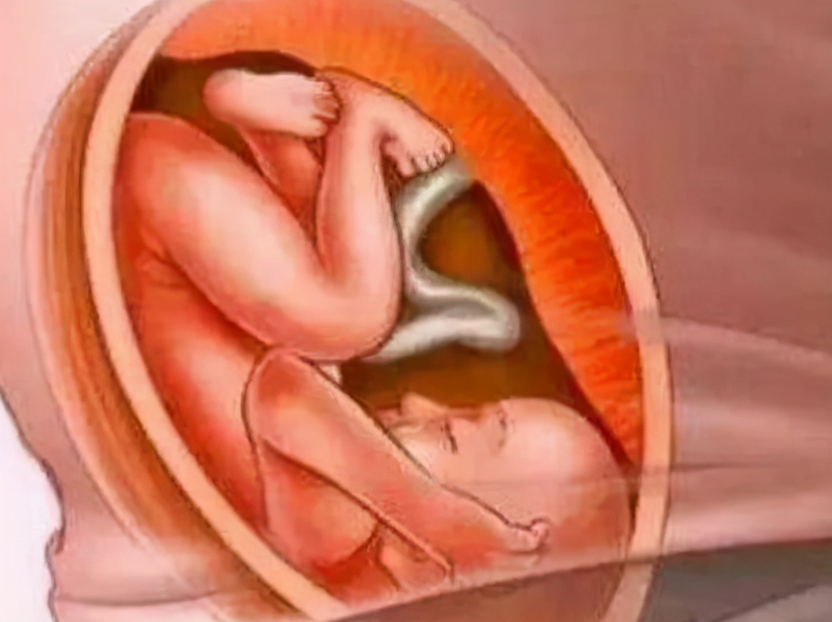 婴儿喜欢抱着走怎么回事,婴儿喜欢抱着走动怎么纠正