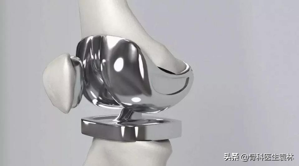 治疗老年关节炎最好方法,老年人关节炎最新治疗方法