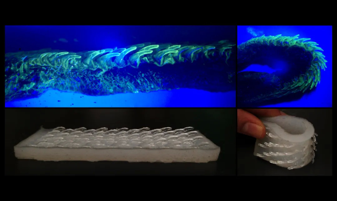 孩子膀胱容量130,儿童最大膀胱容量197正常吗