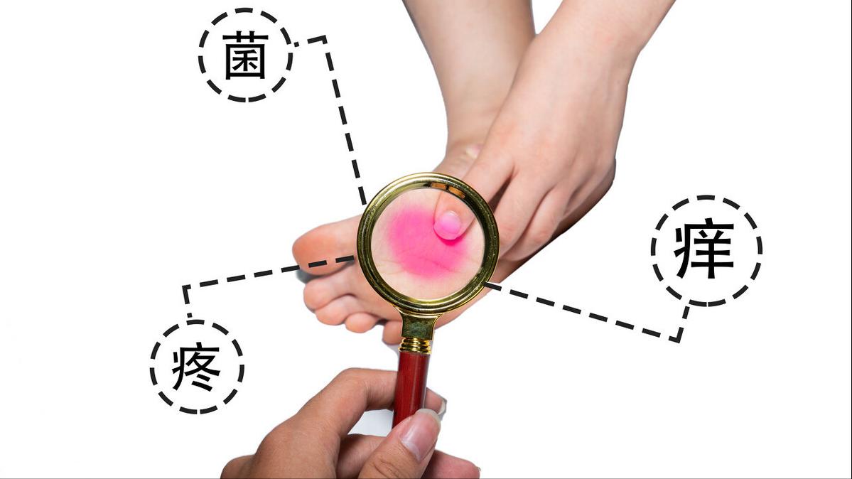 脚上痒痒的还有小疹子怎么回事,脚上手上起小水泡很痒怎么治疗