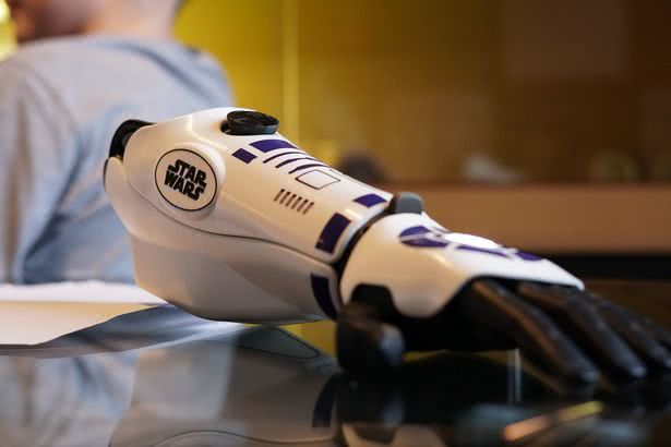 失去四肢的英国少年通过众筹，获《星球大战》仿生手臂得新生，