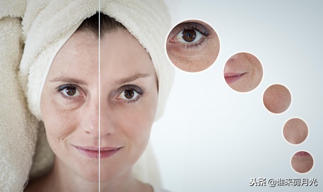 脸上长黑色的小点像痣,脸上突然出现黑色小点