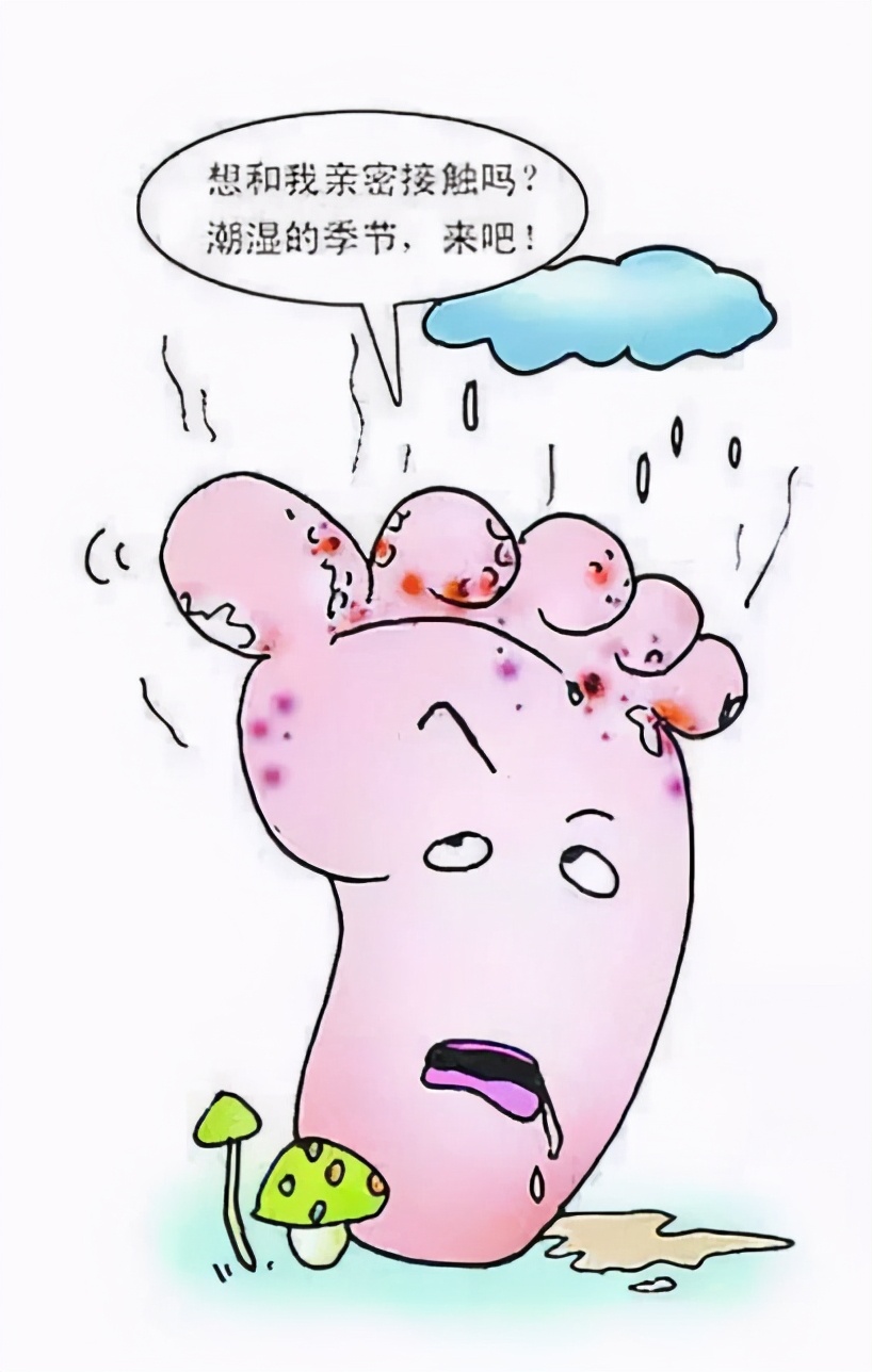 预防脚气的方法有哪些,脚气怎么预防最有效的方法