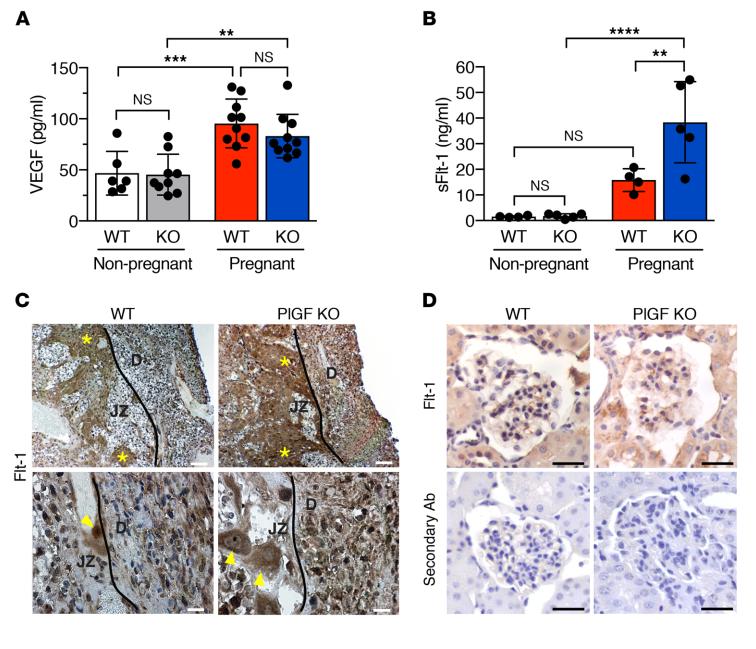 美国癌症中心：阻断胎盘生长因子能够改善妊娠高血压和先兆子痫