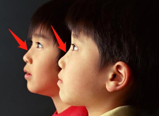 从小开始捏鼻梁会变高吗,从小捏鼻梁