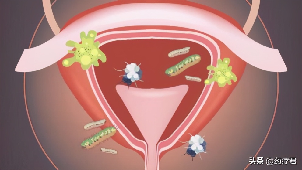 姨妈刚走有措施避孕会怀孕吗,刚来完姨妈且避孕会怀孕吗