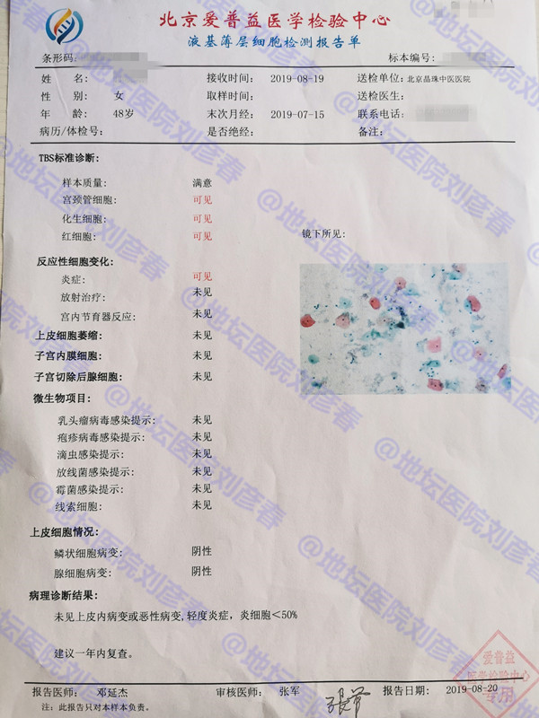 微创热凝杀毒剥脱术是什么手术,微创热凝杀毒剥脱术价格
