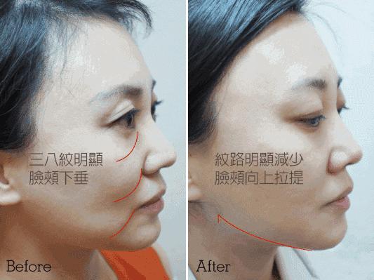 经常这样喝让你的脸色红润还养颜,每天坚持这样喝皮肤又白又嫩