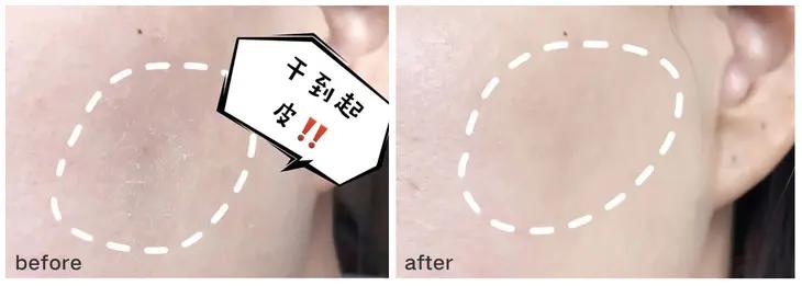 会拉丝的面膜,适合小脸的提拉面膜