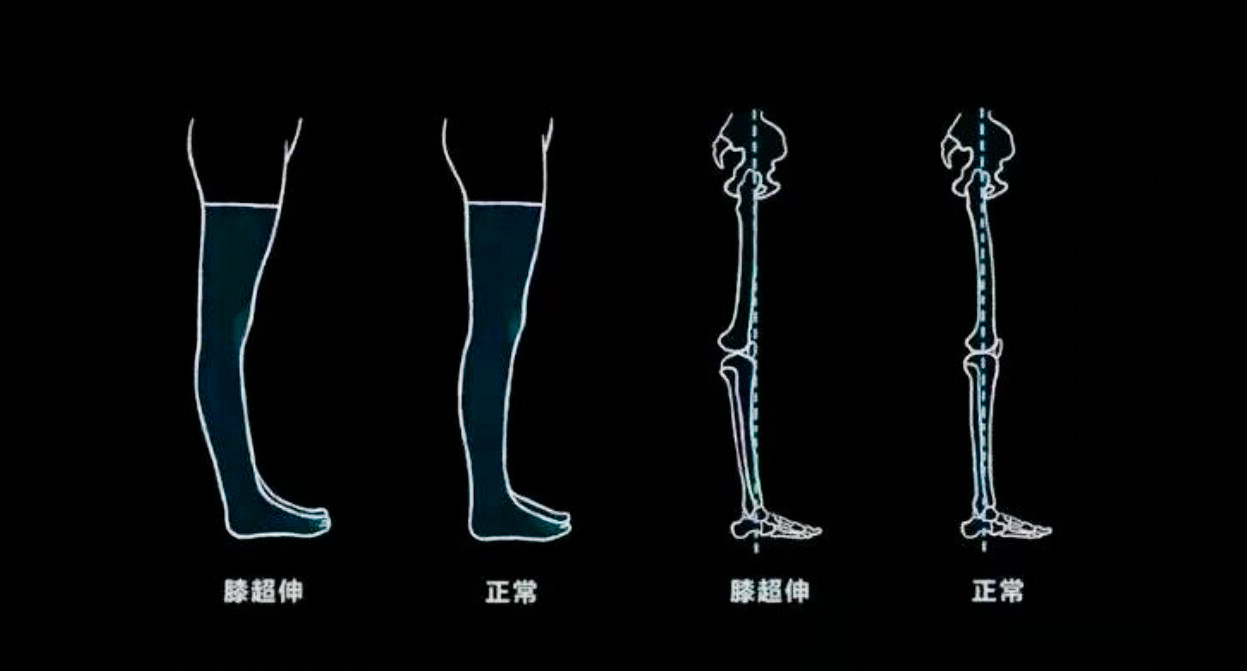 小腿太瘦了怎样可以变粗,小腿粗壮塑形