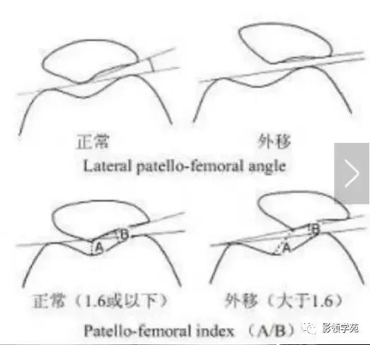 膝关节常见疼痛原因及其缓解方法,膝关节疼痛的16种最常见原因速查