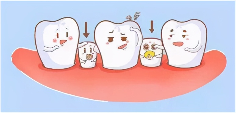 儿童换牙期常见牙齿问题,小朋友换牙新牙已出旧牙没松咋办