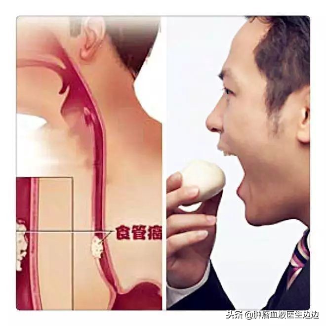 肿瘤医生最常问的问题,癌症重要的早期预警信号