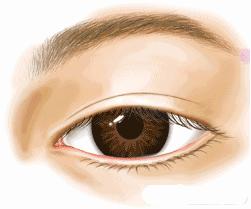 不建议做双眼皮的三种情况,为什么不建议做双眼皮