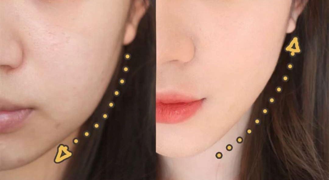 女子为变美花掉300余万后续,女子为变美脸塌陷