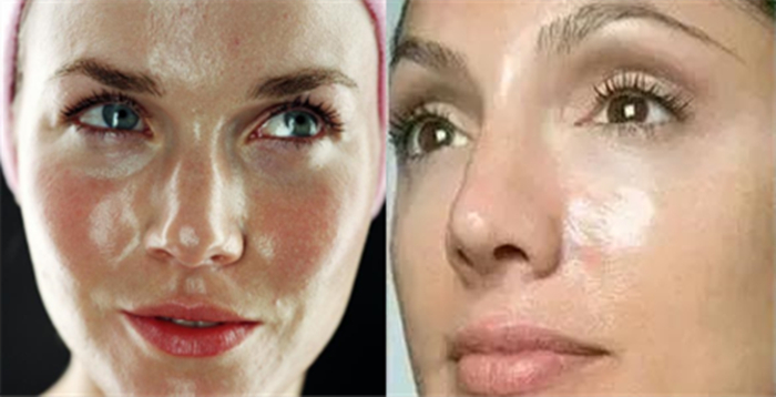 脸色发黄不容忽视,脸色发黄要注意什么