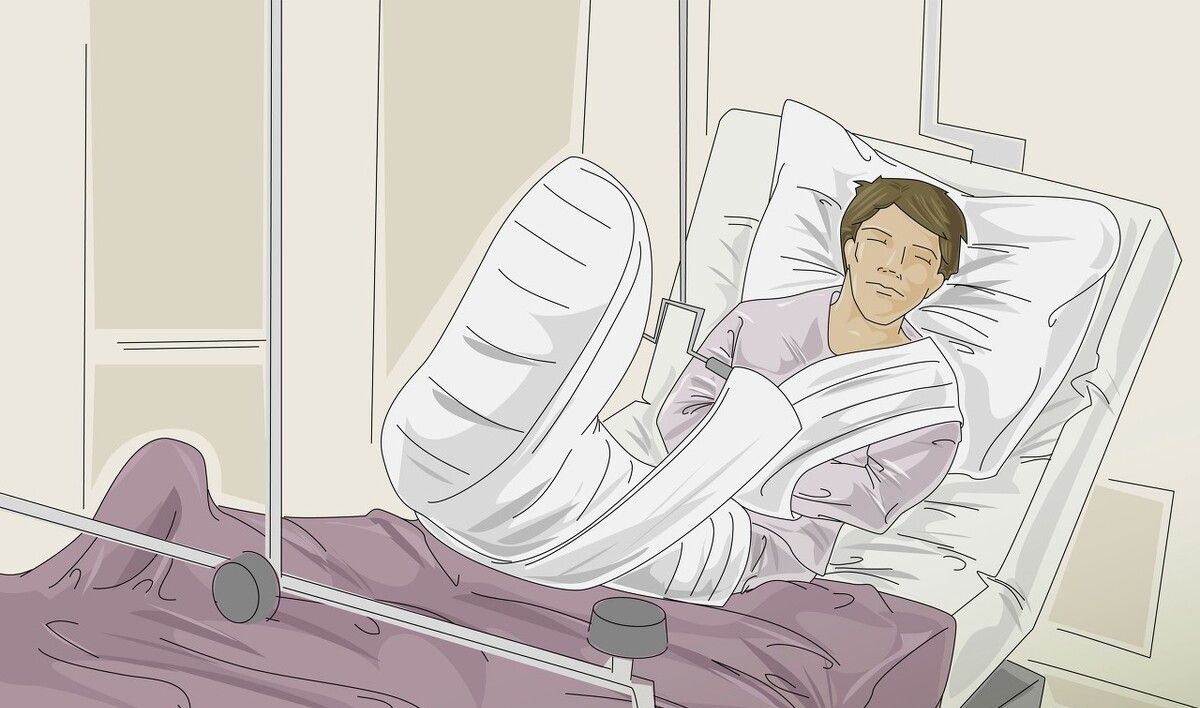 重度骨质疏松的人骨折后恢复,老年人骨折后治疗期间的注意事项