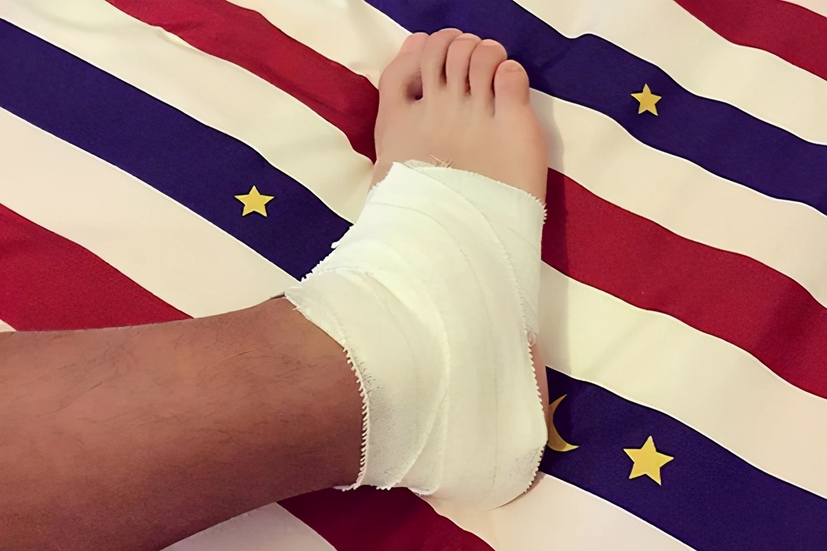 婴儿热水烫伤怎么处理皮肤科,烫伤后皮肤是怎么恢复的