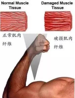 如何缓解健身后的肌肉酸痛,健身48小时后才肌肉酸痛