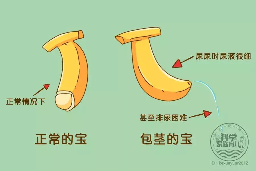 妈妈，痒、疼……6大*处私**问题离娃不远！一出生就要警惕！